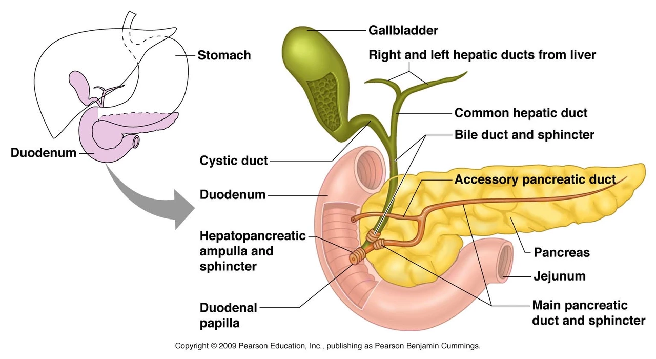 The Importance of Patient Education in Managing Pancreatic Duct Blockage