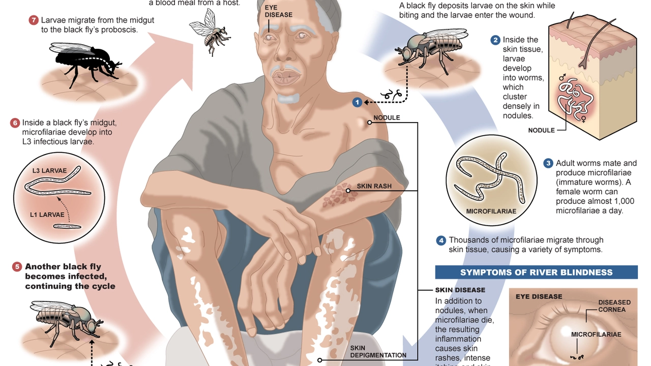 The Role of Ivermectin in River Blindness Eradication Programs